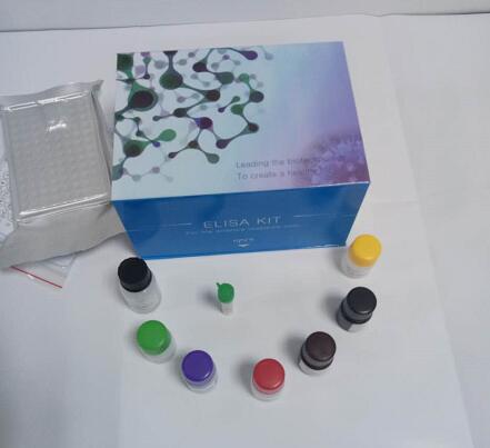 血清总铁结合能力试剂盒 微量法